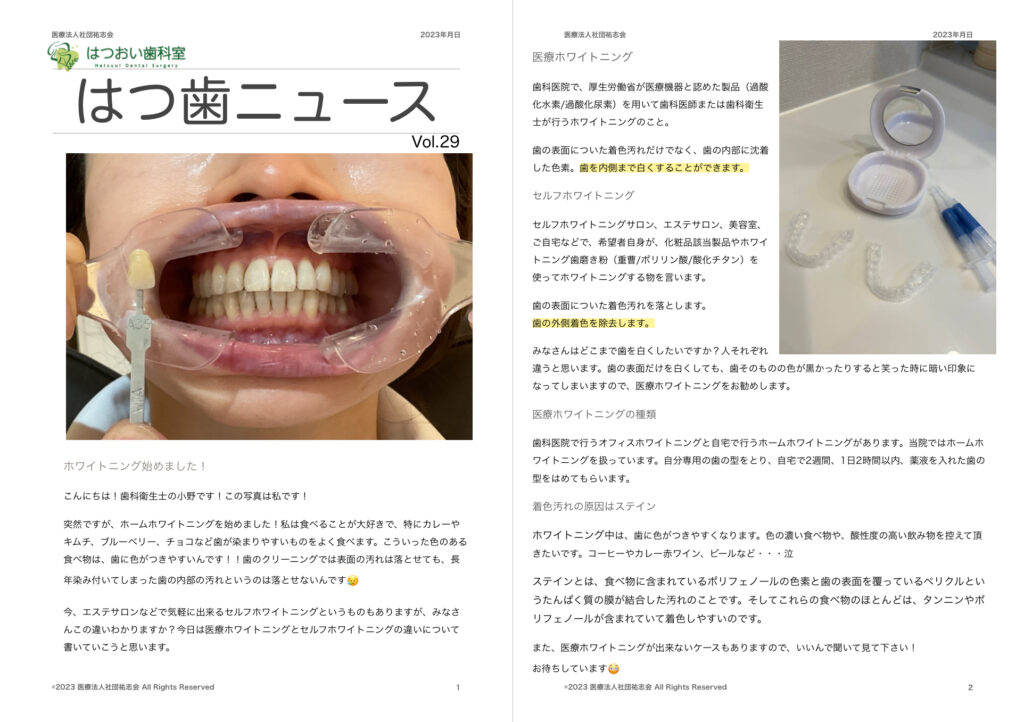 はつおい歯科室のニュースレター 『はつ歯ニュース』vol.29